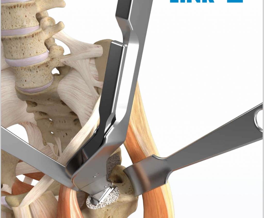 Direct Anterior Approach Direct Anterior Approach Tec